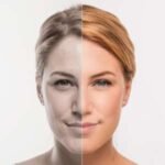 face_treatment_colour_0005_PROFHILO-300x300